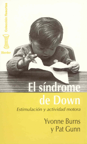 Sídrome de Down, El