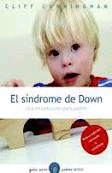 Síndrome de Down, El