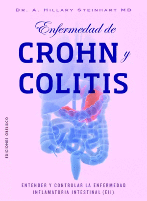 Enfermedad de Crohn y Colitis
